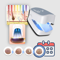 Painless Nail Fungus Laser