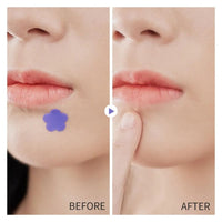 Hydrocolloid Pimple Acne Patch Sticker