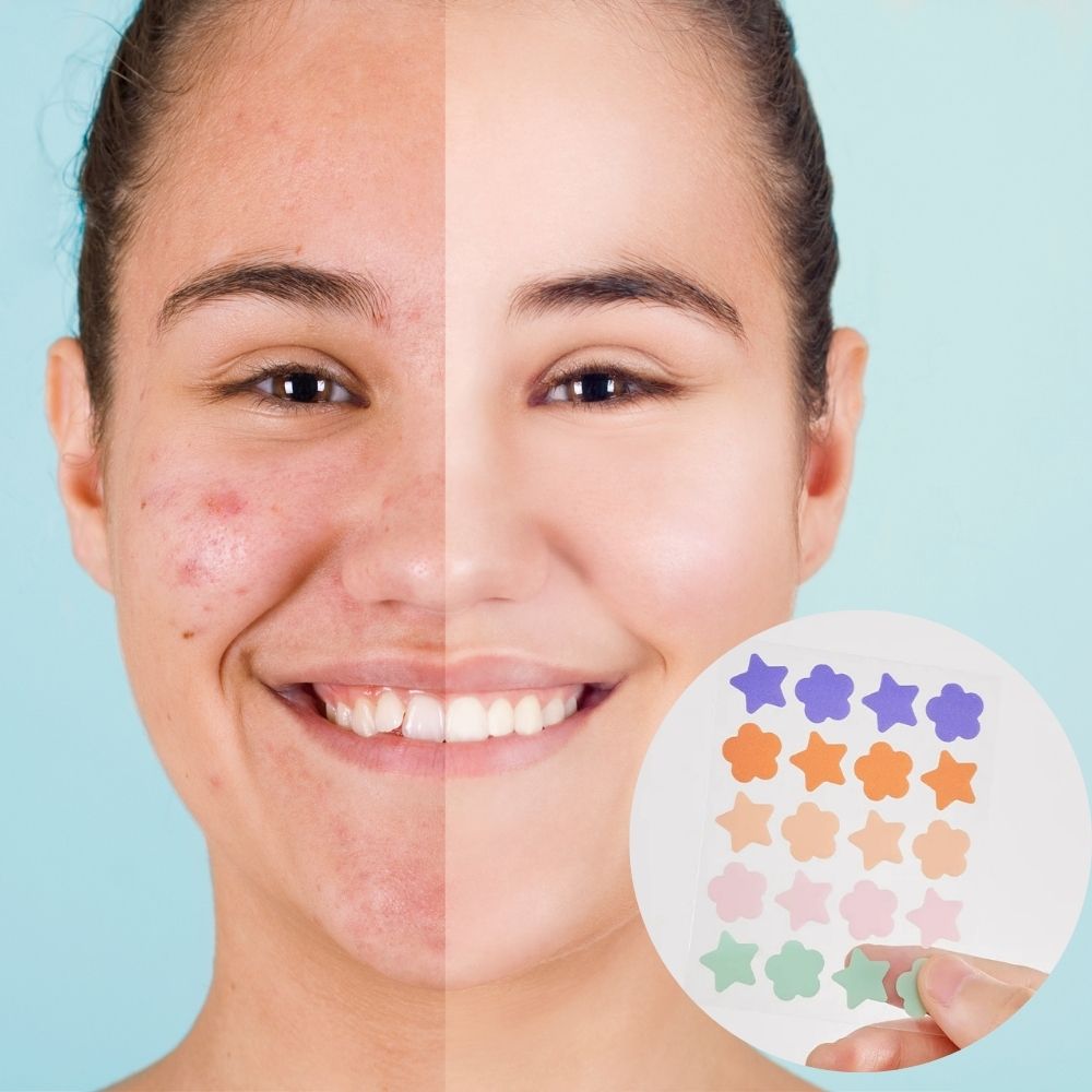 Hydrocolloid Pimple Acne Patch Sticker