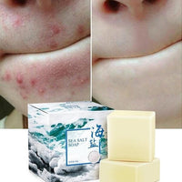 Sea Salt Soap - Acne Treatment