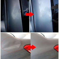 Professional Dent Removal Kit