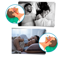 Advanced anti-snoring device