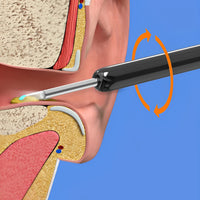 EarBit 3000 - Ear Cleaning Tool With a Camera