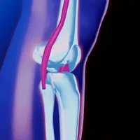Knee Support with Adjustable Compression | for Pain Relief - Injury Recovery - Arthritis and Sports Stability